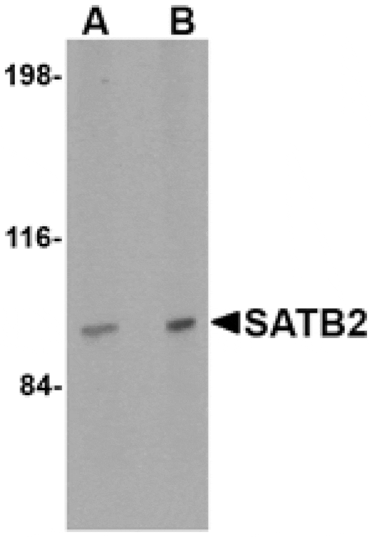 Western blot - SATB2 Antibody from Signalway Antibody (24694) - Antibodies.com