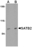 Western blot - SATB2 Antibody from Signalway Antibody (24694) - Antibodies.com