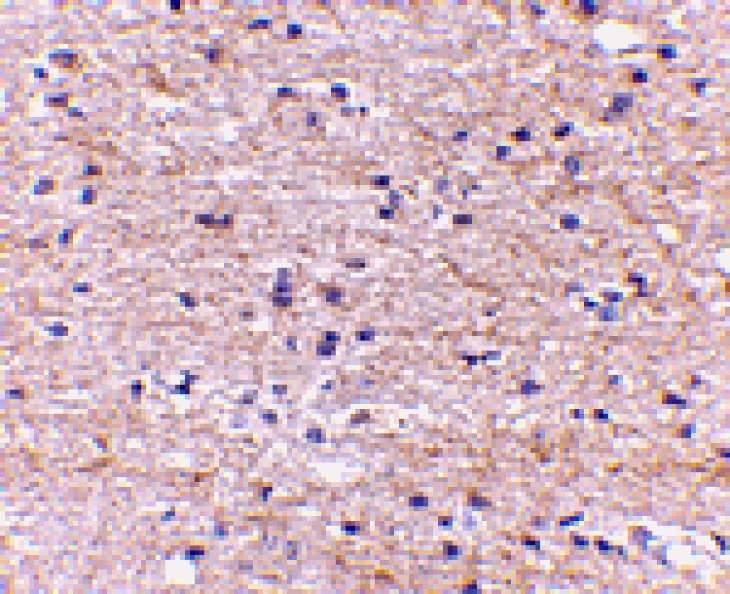 Immunohistochemistry - SATB2 Antibody from Signalway Antibody (24694) - Antibodies.com