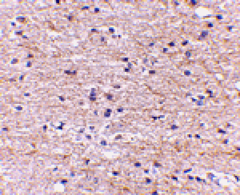 Immunohistochemistry - SATB2 Antibody from Signalway Antibody (24694) - Antibodies.com