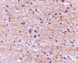 Immunohistochemistry - SATB2 Antibody from Signalway Antibody (24694) - Antibodies.com