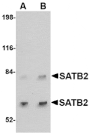 Western blot - SATB2 Antibody from Signalway Antibody (24695) - Antibodies.com