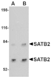 Western blot - SATB2 Antibody from Signalway Antibody (24695) - Antibodies.com
