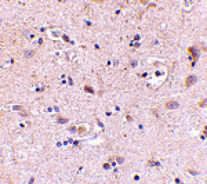 Immunohistochemistry - SATB2 Antibody from Signalway Antibody (24695) - Antibodies.com