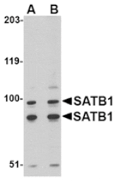 Western blot - SATB1 Antibody from Signalway Antibody (24696) - Antibodies.com