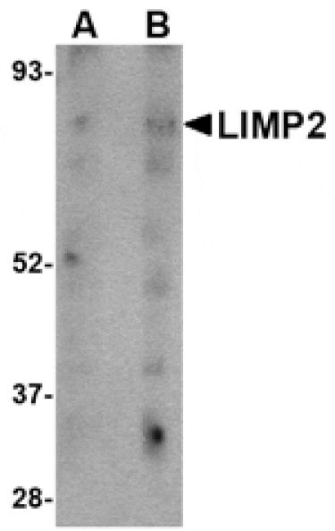 Western blot - LIMP2 Antibody from Signalway Antibody (24706) - Antibodies.com