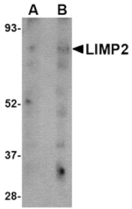 Western blot - LIMP2 Antibody from Signalway Antibody (24706) - Antibodies.com