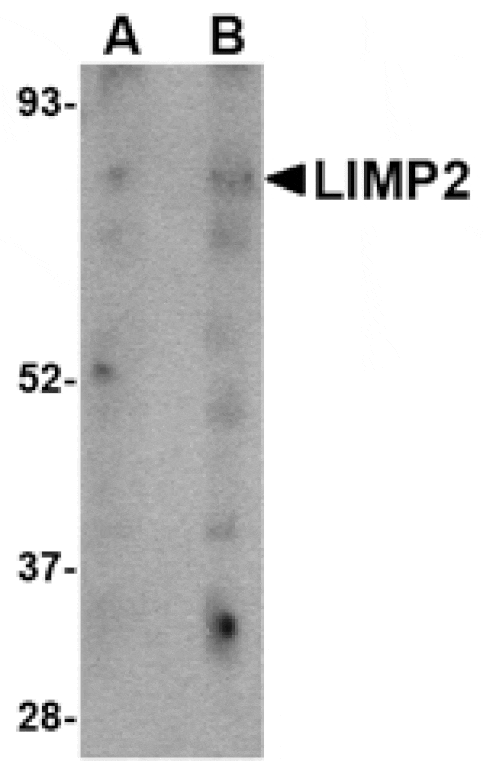 Western blot - LIMP2 Antibody from Signalway Antibody (24706) - Antibodies.com