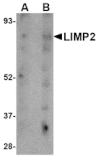 Western blot - LIMP2 Antibody from Signalway Antibody (24706) - Antibodies.com