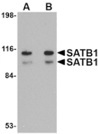 Western blot - SATB1 Antibody from Signalway Antibody (24713) - Antibodies.com