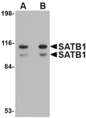 Western blot - SATB1 Antibody from Signalway Antibody (24713) - Antibodies.com