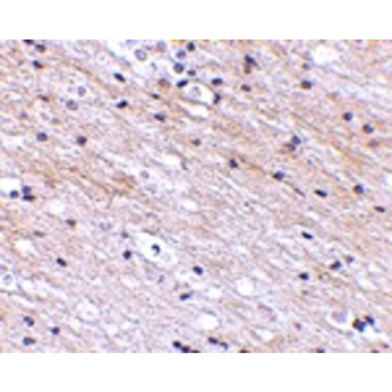 Immunohistochemistry - SATB1 Antibody from Signalway Antibody (24713) - Antibodies.com