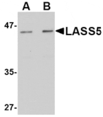 Western blot - LASS5 Antibody from Signalway Antibody (24719) - Antibodies.com