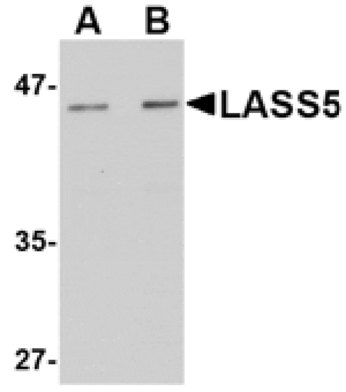 Western blot - LASS5 Antibody from Signalway Antibody (24719) - Antibodies.com