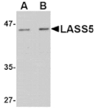 Western blot - LASS5 Antibody from Signalway Antibody (24719) - Antibodies.com
