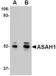 Western blot - ASAH1 Antibody from Signalway Antibody (24730) - Antibodies.com