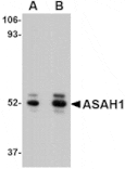 Western blot - ASAH1 Antibody from Signalway Antibody (24730) - Antibodies.com