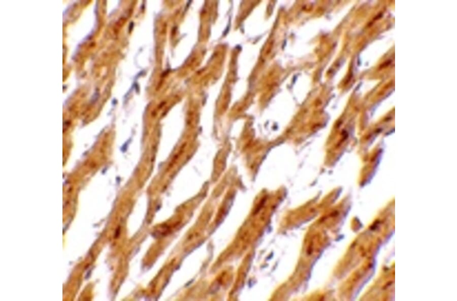 Immunohistochemistry - ASAH1 Antibody from Signalway Antibody (24730) - Antibodies.com