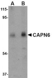 Western blot - CAPN6 Antibody from Signalway Antibody (24738) - Antibodies.com