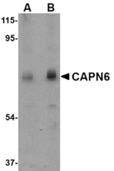 Western blot - CAPN6 Antibody from Signalway Antibody (24738) - Antibodies.com