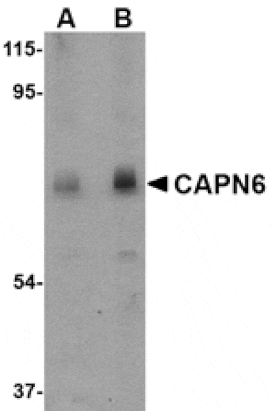 Western blot - CAPN6 Antibody from Signalway Antibody (24738) - Antibodies.com