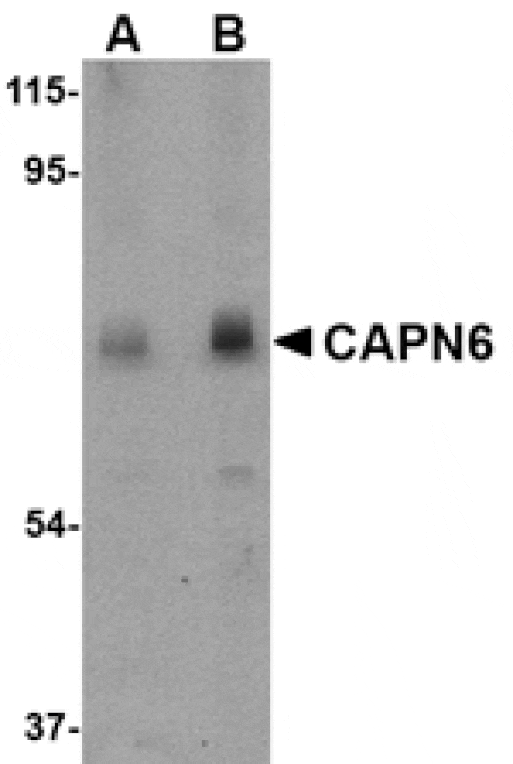 Western blot - CAPN6 Antibody from Signalway Antibody (24738) - Antibodies.com