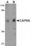 Western blot - CAPN6 Antibody from Signalway Antibody (24738) - Antibodies.com