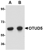 Western blot analysis of OTUD5 in human kidney lysate with OTUD5 antibody at (A) 1 and (B) 2 µg/mL.