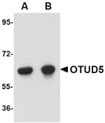 Western blot - OTUD5 Antibody from Signalway Antibody (24761) - Antibodies.com