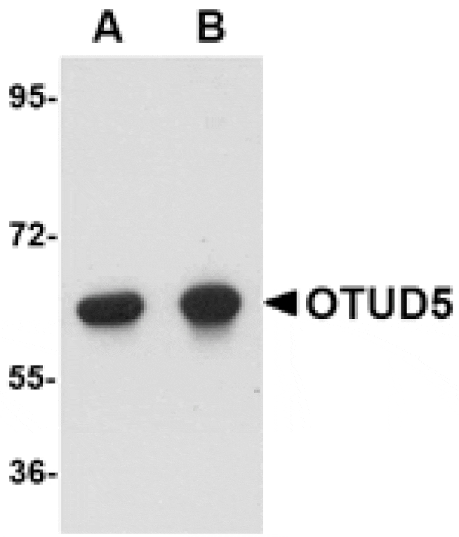 Western blot - OTUD5 Antibody from Signalway Antibody (24761) - Antibodies.com