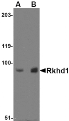 Western blot - Rkhd1 Antibody from Signalway Antibody (24769) - Antibodies.com