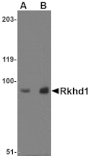Western blot - Rkhd1 Antibody from Signalway Antibody (24769) - Antibodies.com