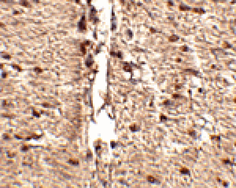 Immunohistochemistry - Rkhd1 Antibody from Signalway Antibody (24769) - Antibodies.com