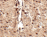 Immunohistochemistry - Rkhd1 Antibody from Signalway Antibody (24769) - Antibodies.com