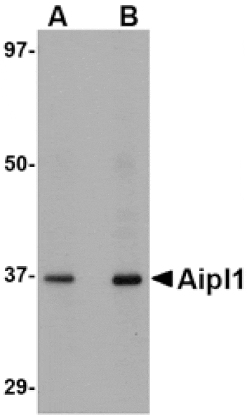 Western blot - Aipl1 Antibody from Signalway Antibody (24776) - Antibodies.com