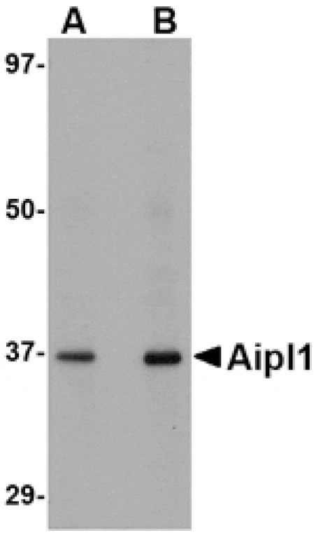 Western blot - Aipl1 Antibody from Signalway Antibody (24776) - Antibodies.com