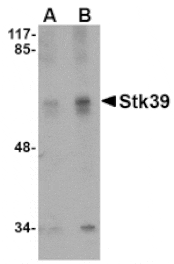 Western blot - Stk39 Antibody from Signalway Antibody (24777) - Antibodies.com