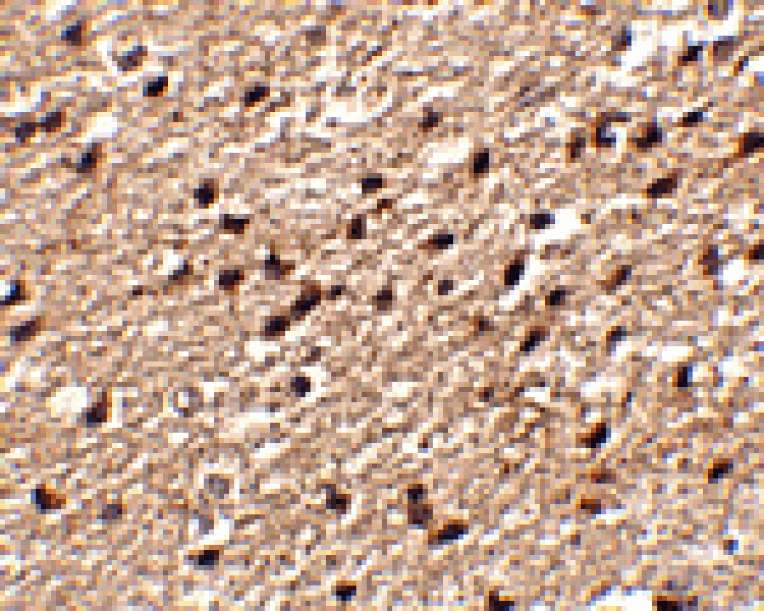 Immunohistochemistry - Stk39 Antibody from Signalway Antibody (24777) - Antibodies.com