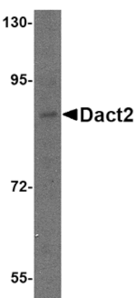 Western blot - Dact2 Antibody from Signalway Antibody (24779) - Antibodies.com