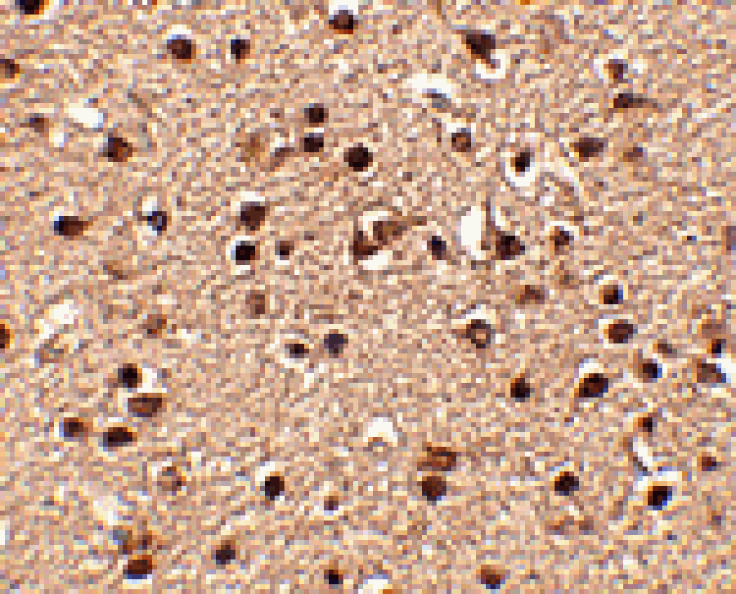 Immunohistochemistry - Dact2 Antibody from Signalway Antibody (24779) - Antibodies.com