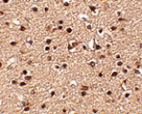Immunohistochemistry - Dact2 Antibody from Signalway Antibody (24779) - Antibodies.com