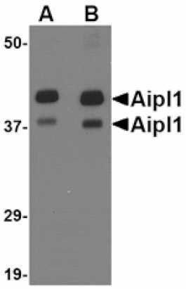 Western blot - Aipl1 Antibody from Signalway Antibody (24780) - Antibodies.com