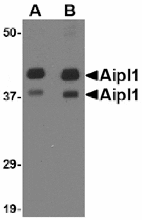Western blot - Aipl1 Antibody from Signalway Antibody (24780) - Antibodies.com