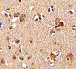 Immunohistochemistry - Aipl1 Antibody from Signalway Antibody (24780) - Antibodies.com