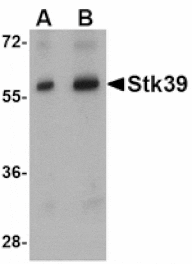 Western blot - Stk39 Antibody from Signalway Antibody (24781) - Antibodies.com