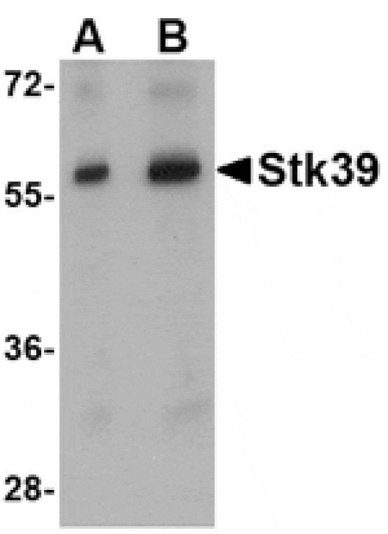 Western blot - Stk39 Antibody from Signalway Antibody (24781) - Antibodies.com