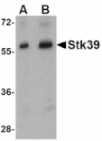 Western blot - Stk39 Antibody from Signalway Antibody (24781) - Antibodies.com