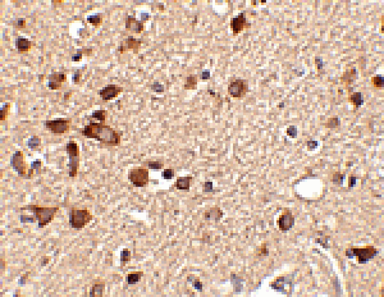 Immunohistochemistry - Stk39 Antibody from Signalway Antibody (24781) - Antibodies.com