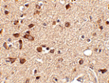 Immunohistochemistry - Stk39 Antibody from Signalway Antibody (24781) - Antibodies.com