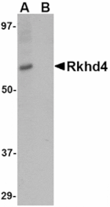 Western blot - Rkhd4 Antibody from Signalway Antibody (24782) - Antibodies.com